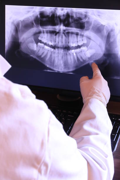 Best Urgent Care for Lost Fillings or Crowns in Corunna, MI